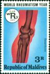 Colnect-4556-800-Rheumatic-knee.jpg