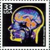 Colnect-201-002-Celebrate-the-Century---1970-s----Medical-Imaging.jpg